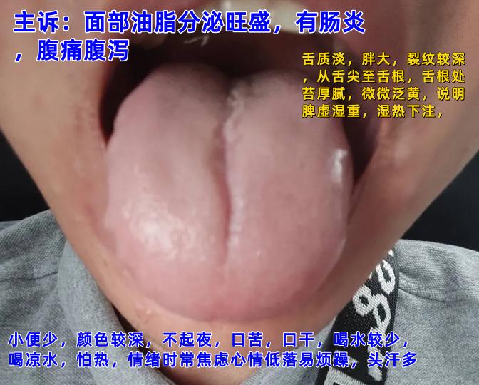现在不忙，抽空来帮大家分析舌象

你来发，我来看

注意：
拍照尽量露出整个舌面