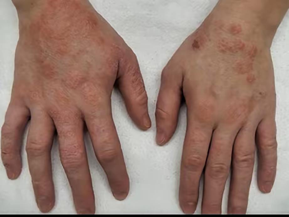 云南，广西先行一步，艾滋病告知新规出来了，婚检艾滋病检测，并会将结果强制告知配偶