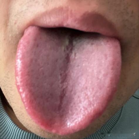 次次不到1分钟，技术不行，欲望还大，你不虚谁虚？[敲打][敲打]
主诉：经常控制