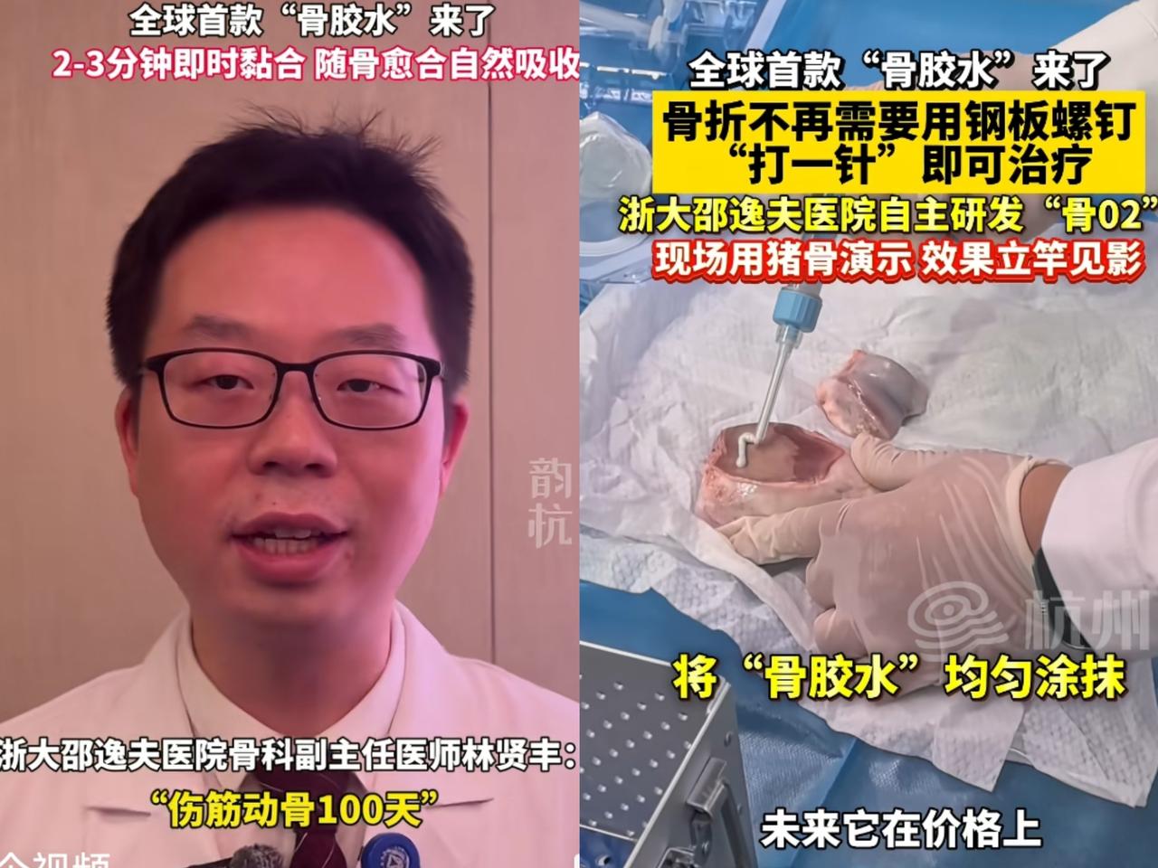 这事可太长脸了！
不光国内传遍了，全球都在盯着呢！
谁懂啊，以后骨折不用遭打钢钉