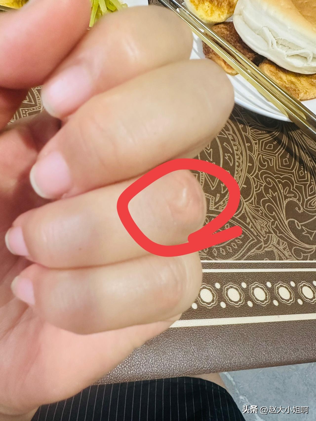 咱就说我要不要投诉一下这店铺老板？
看看把我烫的。
我在做饭她给我打电话说跟我商