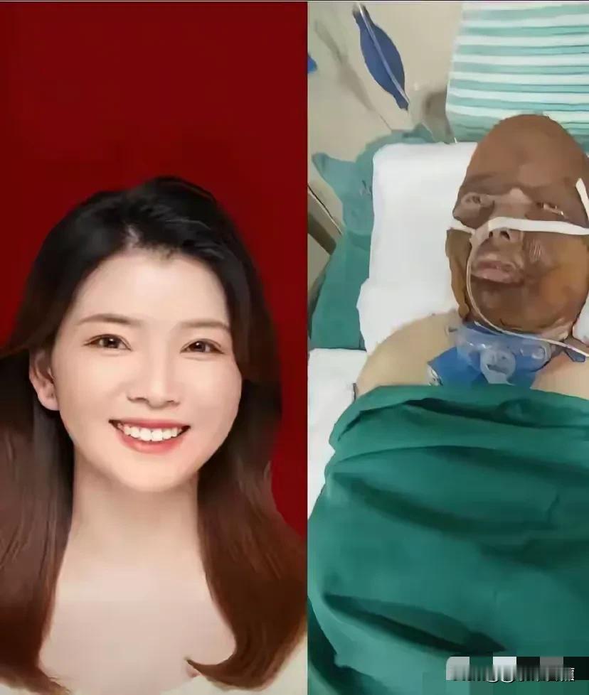 浙江妈妈用生命守护孩子！
昨晚，浙江的一位妈妈，在煤气爆炸的瞬间，冲向了孩子，用