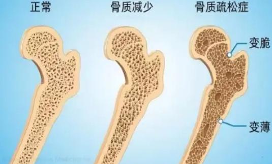年纪大了要少散步？医生告诫：到了60岁以后，散步时这3事要避开


王阿姨是个典