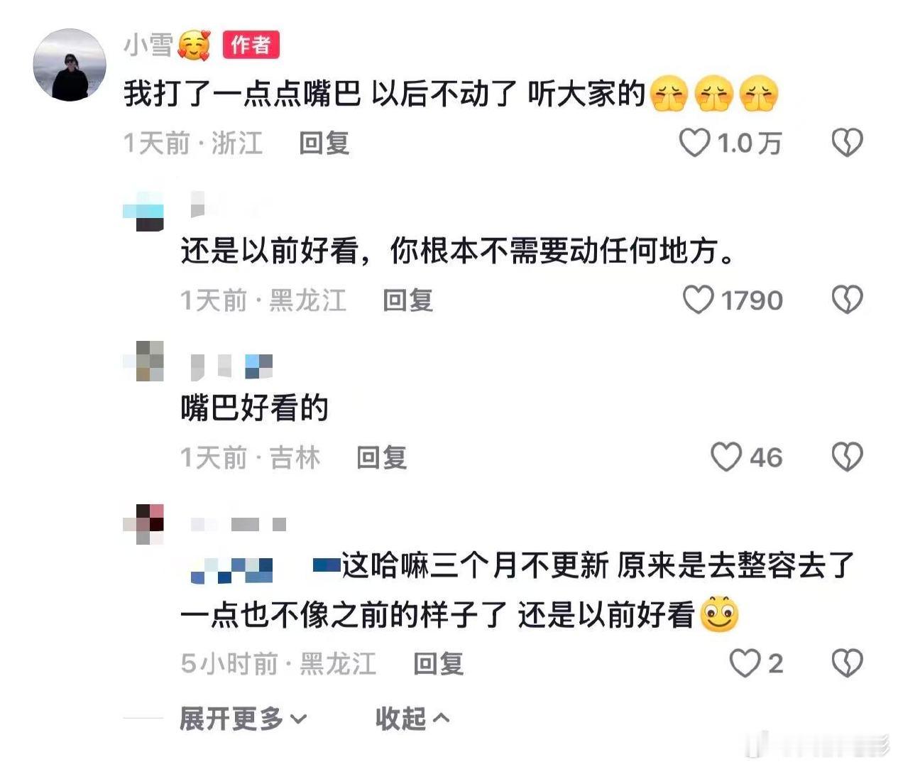 张百乔老婆小雪整容张百乔老婆回应整容 12月22日晚，张百乔老婆小雪在社交平台晒