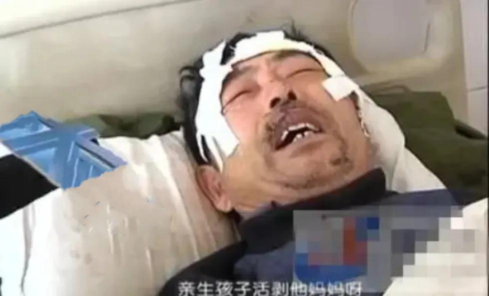 2013年，一对老夫妻被人用利刃疯狂砍杀，其中老汉手脚筋都被挑断，老伴的头皮被活