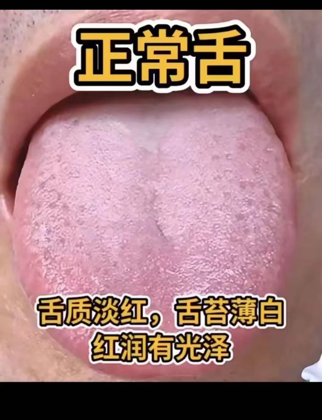 #中医##育儿专家说# ❤健康调理的路上最先放弃的不是孩子，而是家长因为太忙，因