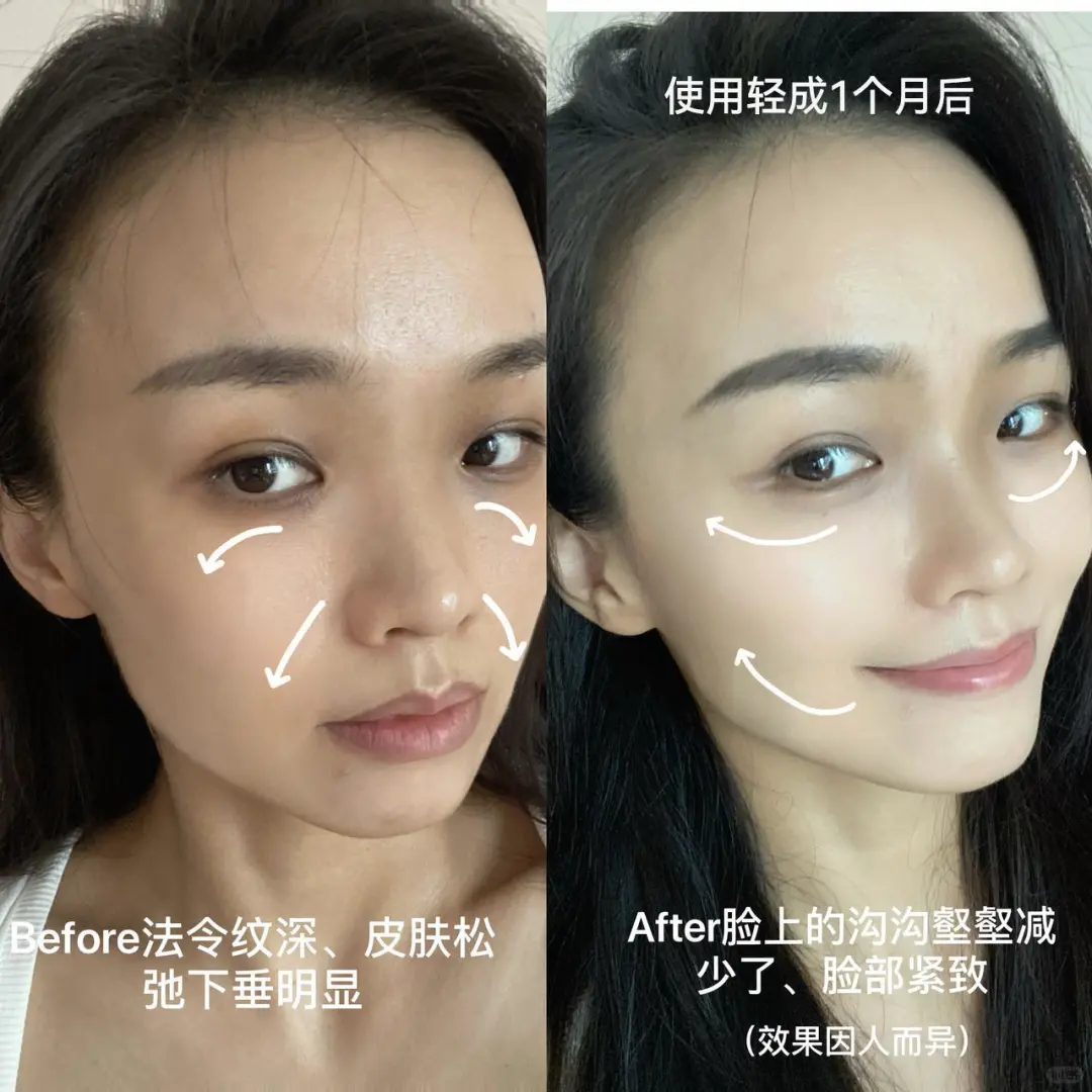 34岁宝妈丨美容仪决赛圈，到底买哪个好？