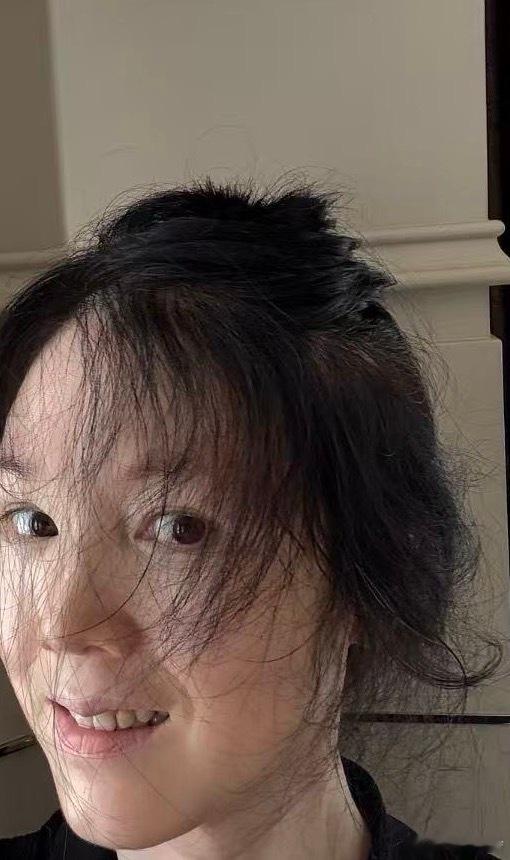 我要来炫耀一下我新长的头发 