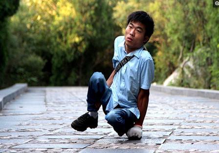 “我现在不考虑娶媳妇了！”河南商丘 36 岁苦命男子，跟自身顽疾死磕 20 年硬