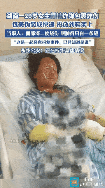 湖南icon29岁女主播在家准备拆快递时，只是看了一眼包裹还没来的及拆开就发生了