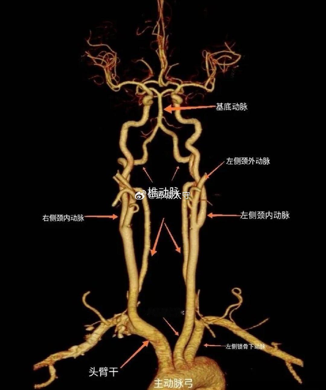 【36岁宝妈用筋膜枪按摩突发脑梗国医的精诚力量  】这是一个非常典型且需要高度警