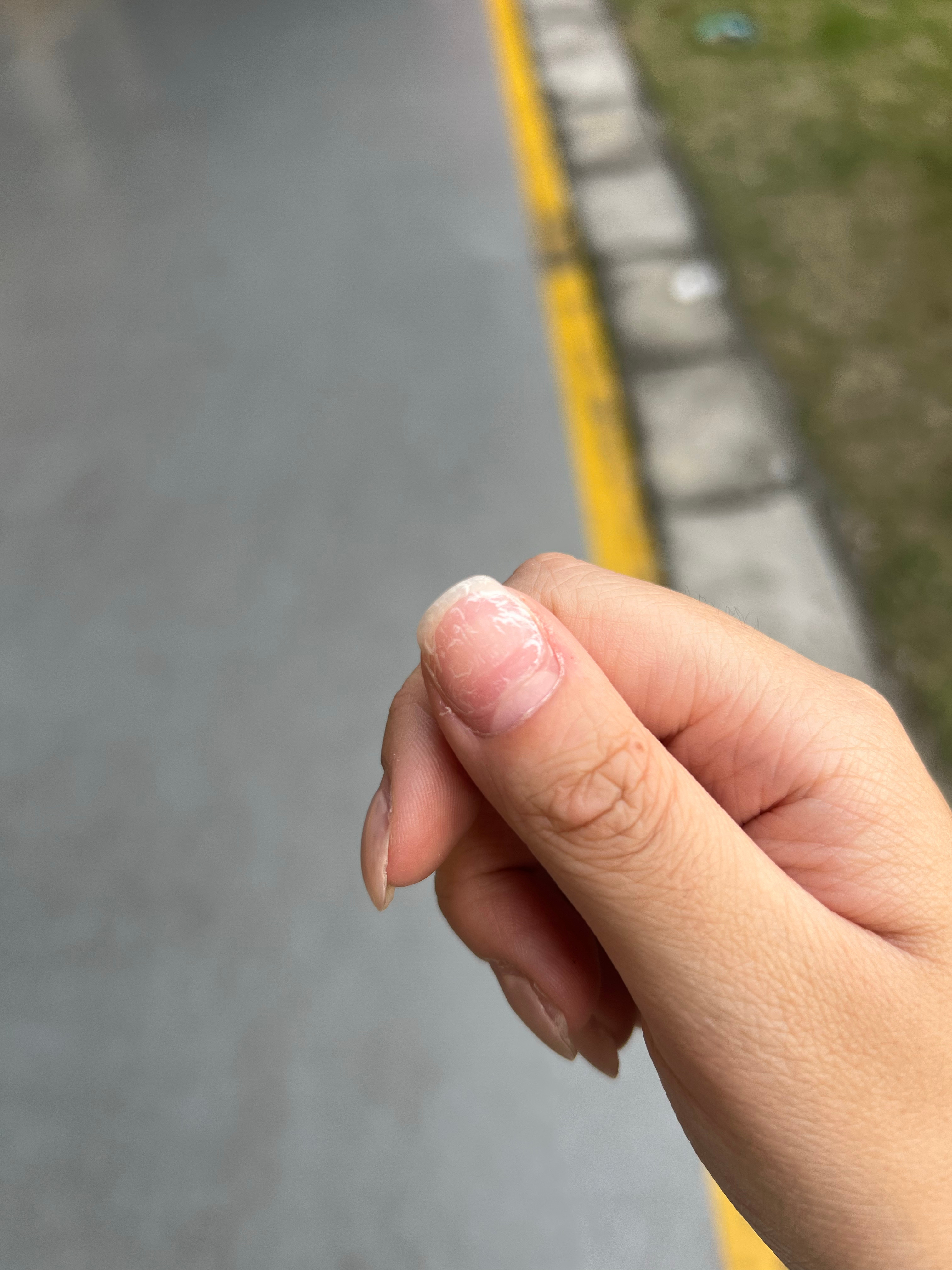 所有人心疼我的指甲 