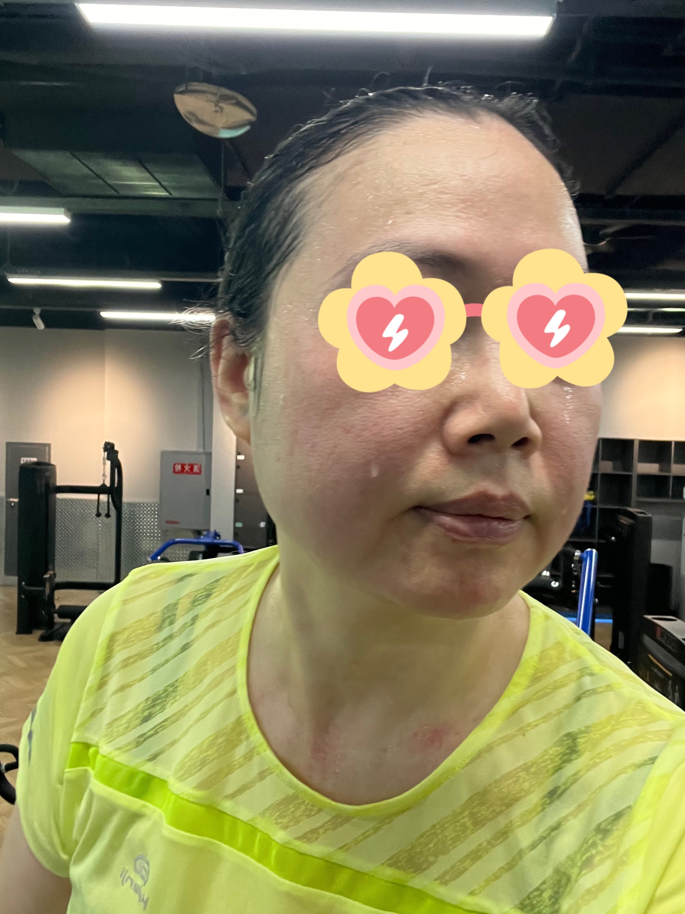胳膊上的汗居然可以凝结成滴。随手拍 为什么汗水要走泪水的路啊。真不是爬楼梯爬哭了