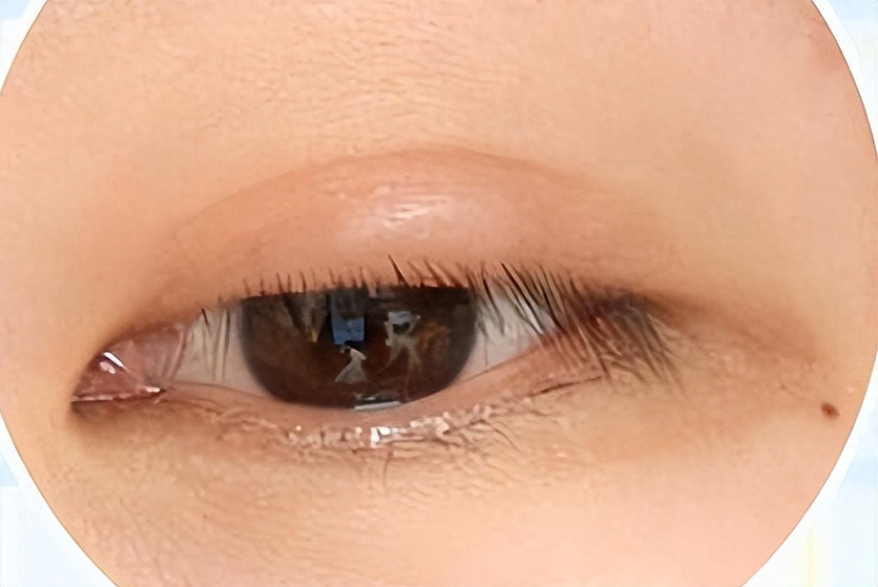 一瓶桂附地黄丸，摆平 5 种常见病！对症用才是真本事
我是陈大夫⚠️温馨提醒：桂