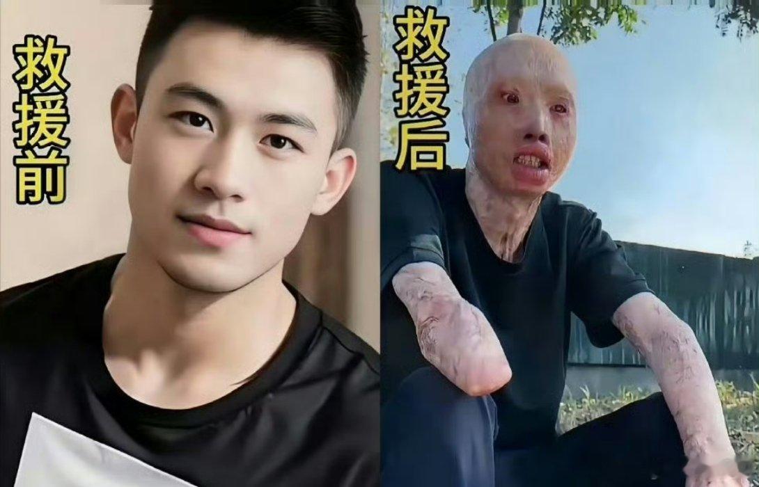 救火英雄救援前与救援后。看哭了这就是人民英雄，致敬！！！