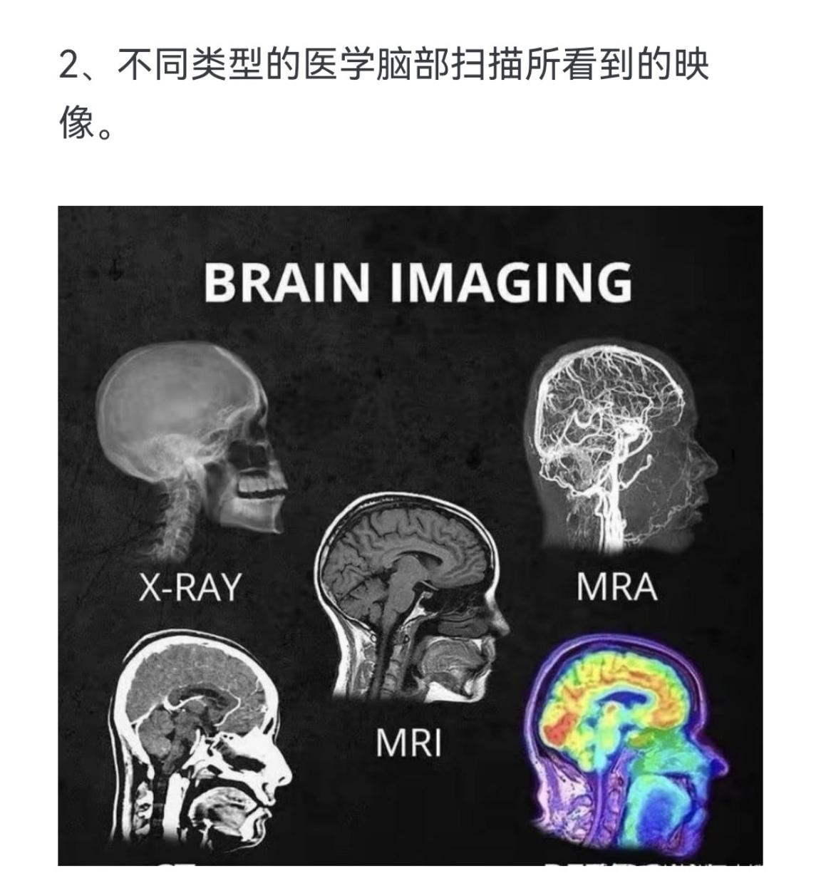 不同类型的医学脑部扫描所看到的映像