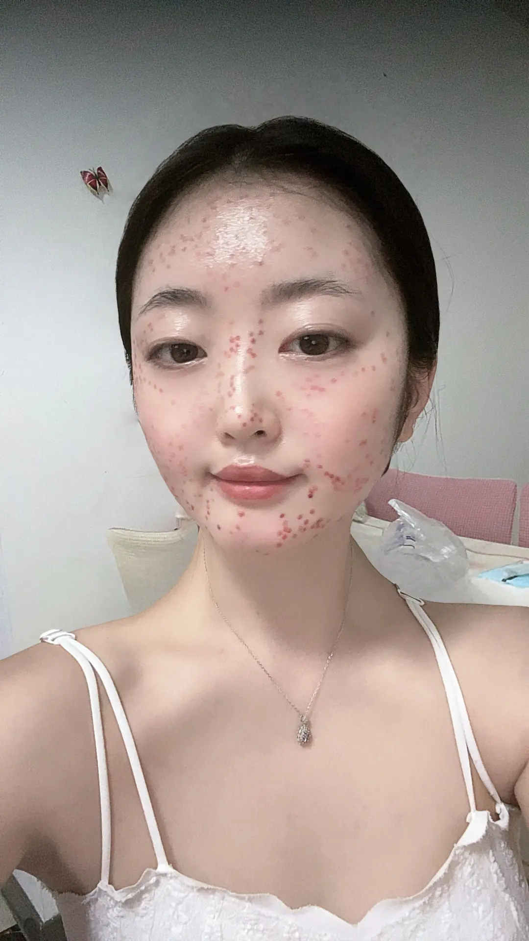 煎熬，才第二天，忍不了了