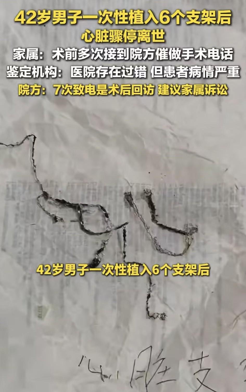 一次性植入6个支架！为啥不搭桥呢？
有个朋友心梗，需要植入4个支架，一开始只植入