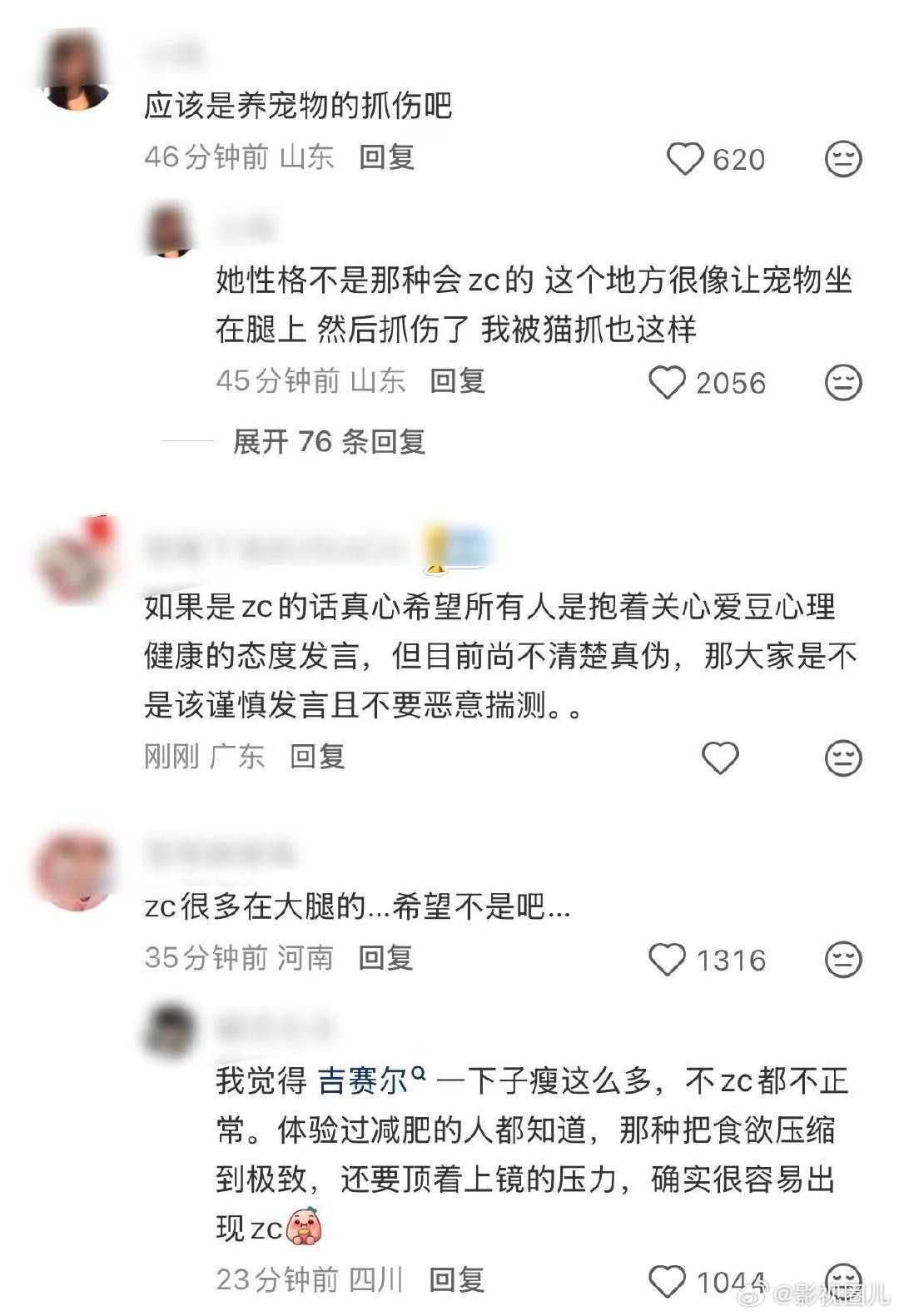吉赛尔的腿咋了 吉赛尔最新舞台直拍 大腿上好多抓痕啊 咋回事？！吉赛尔大腿抓痕