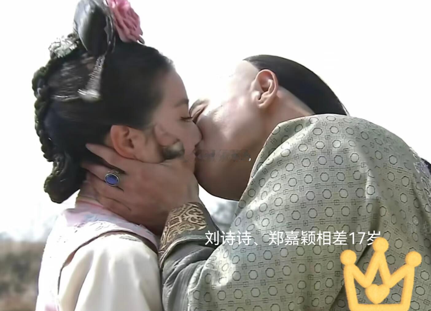 女演员，是不是集体工伤 