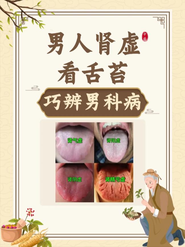 男人肾虚，中医看舌苔巧辨难言之隐
