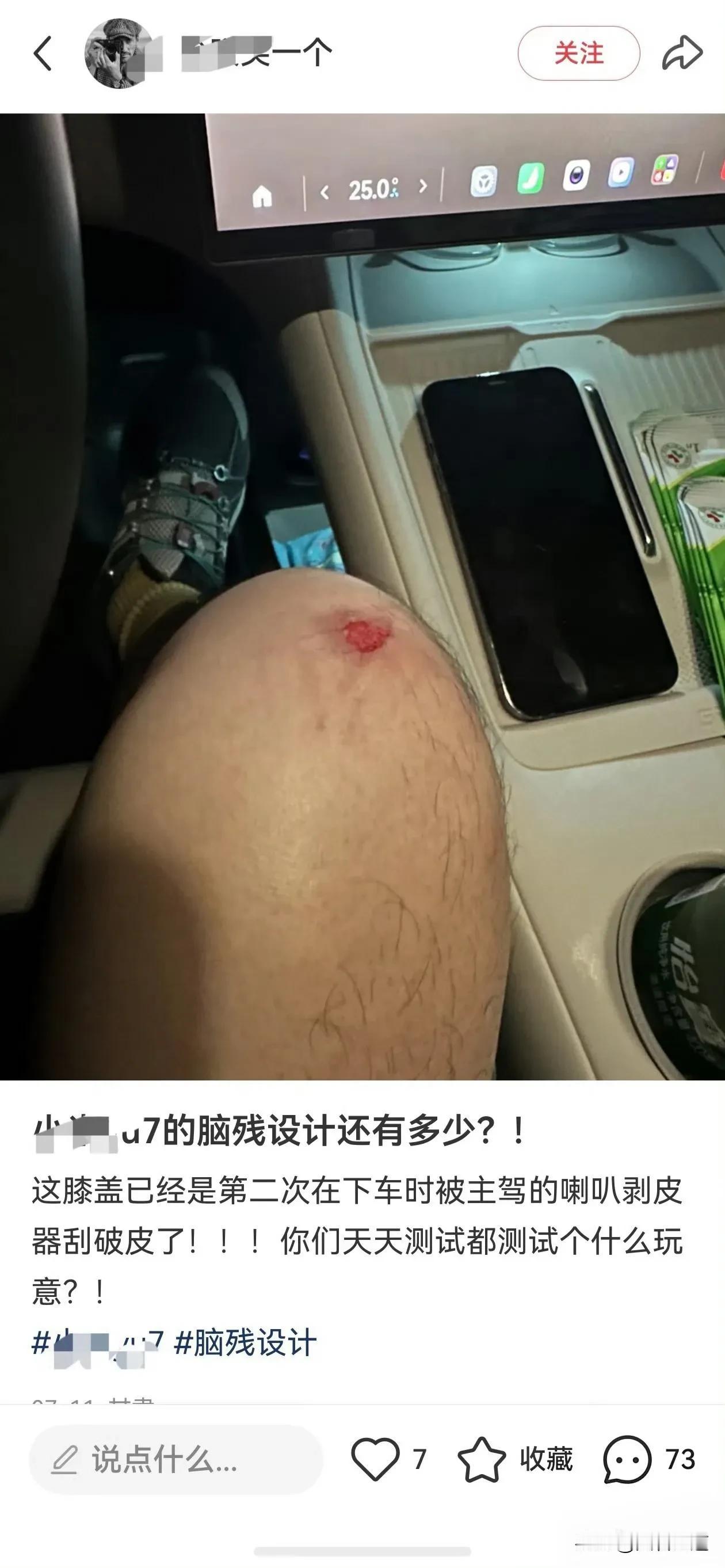 洋葱帝测试尊界，拿洋葱去蹭音响面板！
没想到真有其他品牌车主真实遭遇了“喇叭剥皮