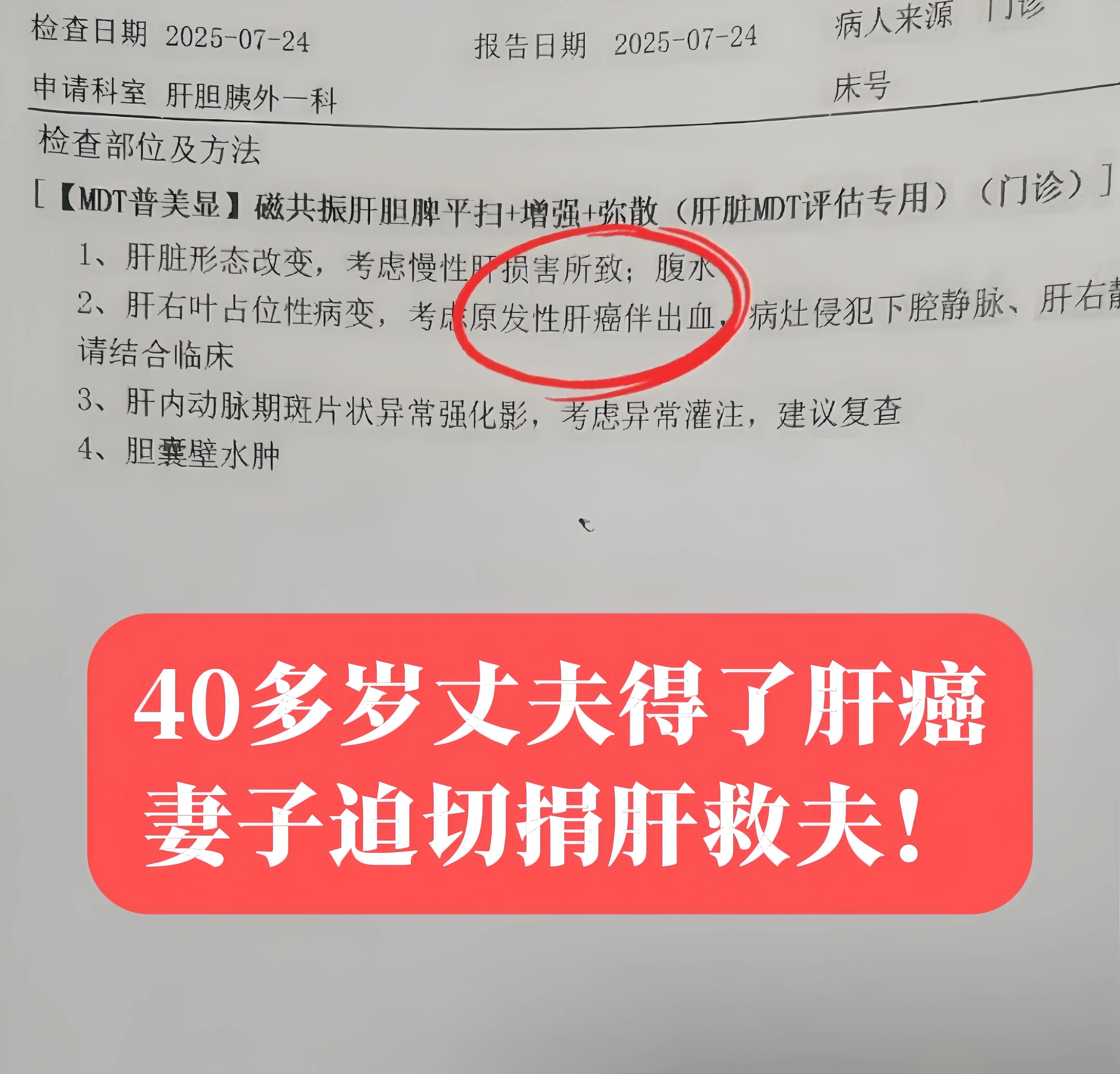 “只要配型合适，我愿意给我老公换肝！”前天专家门诊来了对从东北过来的夫...
