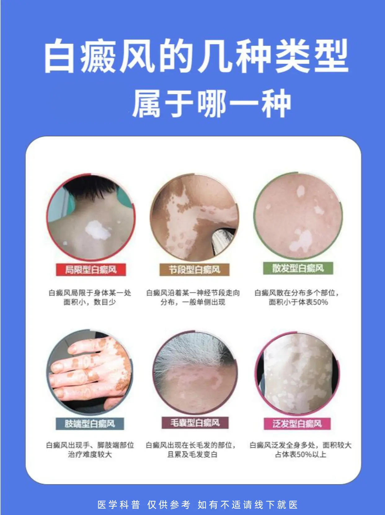 白癜风 白斑 皮肤健康