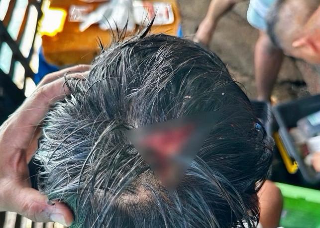 当场开瓢，菲律宾被揍了。7月20日，菲律宾军方发布声明，一名菲律宾海军人员在南海