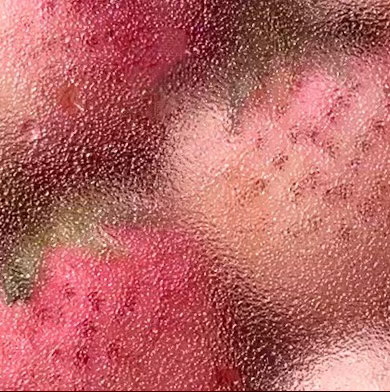种植 草莓的种植方法：1. 土壤条件：草莓喜欢肥沃、疏松、透气且排水良好的土壤，