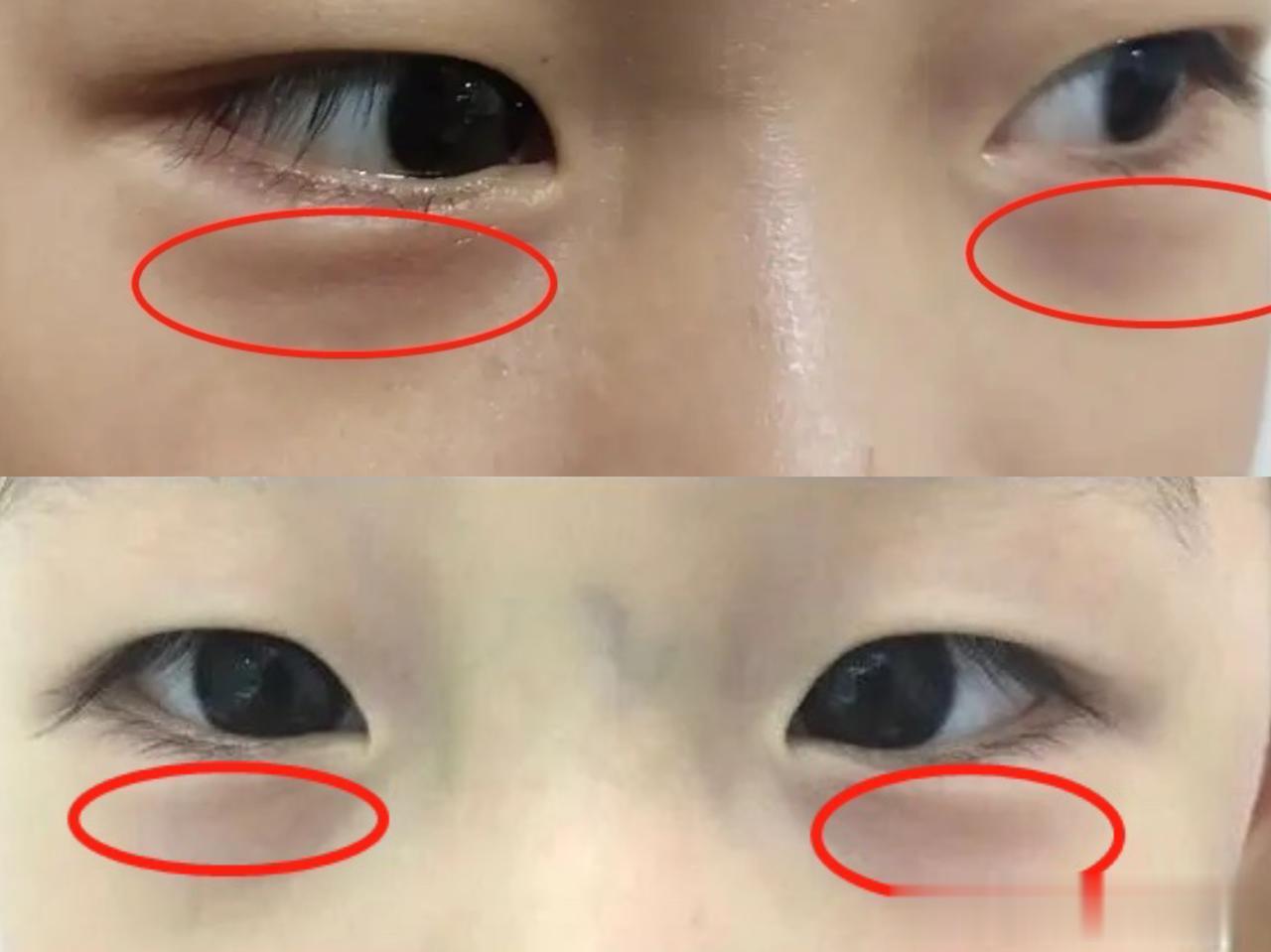孩子脾胃差、易积食，脸上这些部位会说话！
 
近期很多家长都向我提问有关孩子的脾