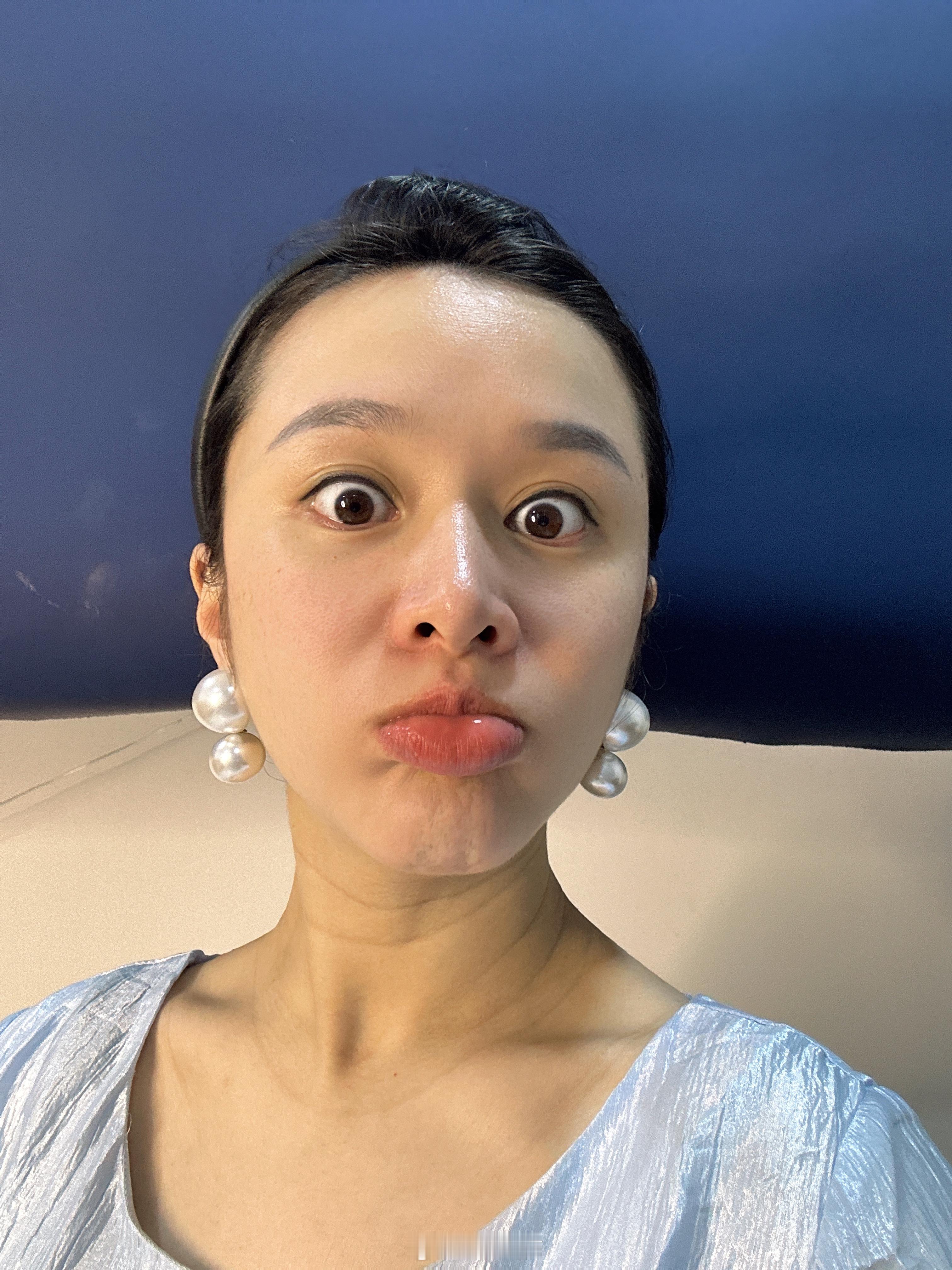 1无滤镜，2有滤镜。新赛季，冲起来！#呆阿拿[超话]# ​​​