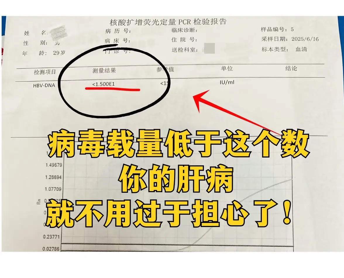 乙肝病毒低于这个数，就不用过于担心了！  乙肝病毒量低于这个数才安全!...