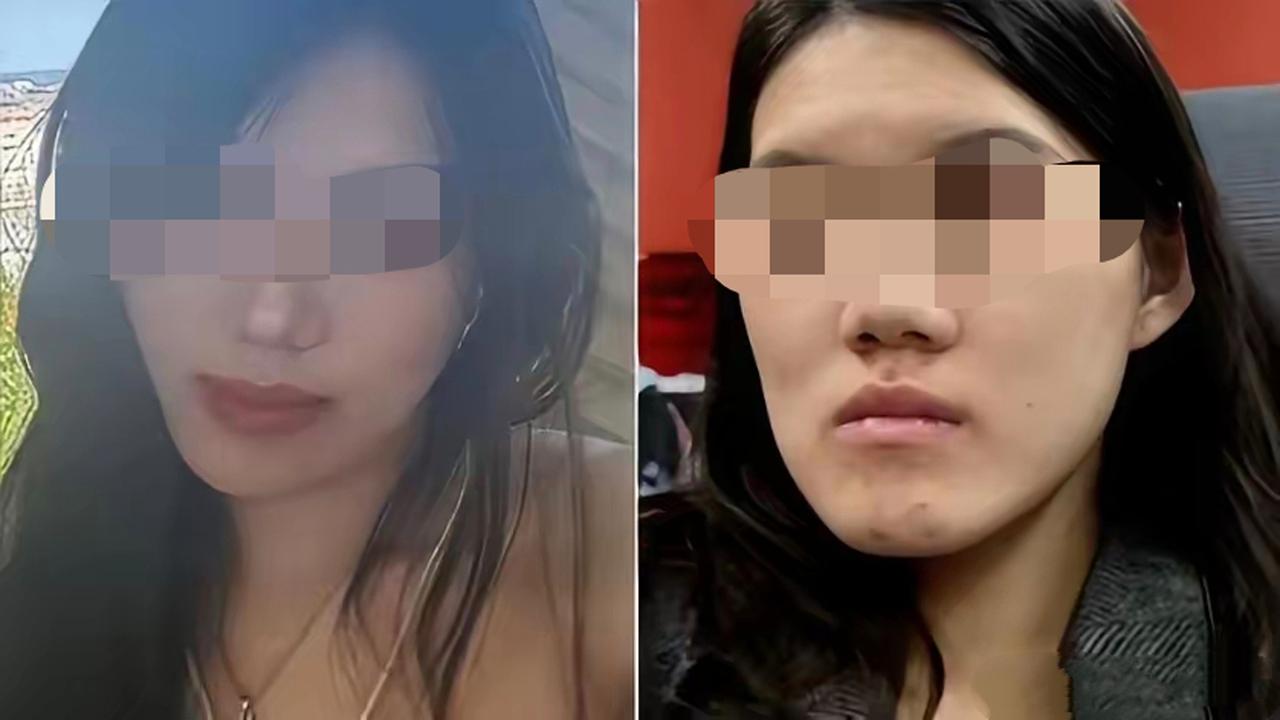 【正颌手术被做反！周兆成：医疗失误该如何追责】
 
近期武汉女孩正颌手术事故全网