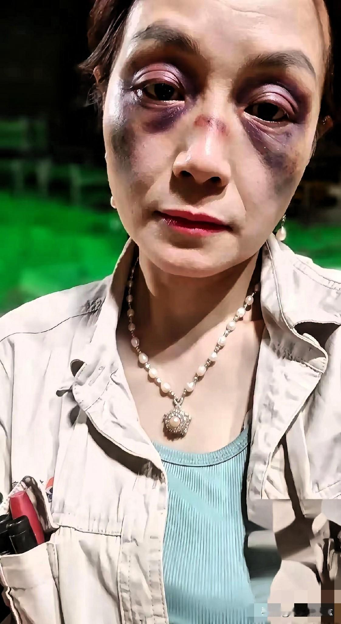 昨晚大排档那场闹剧，看得人心里真不是滋味。

36岁的女同事，离异单身，加完班跟