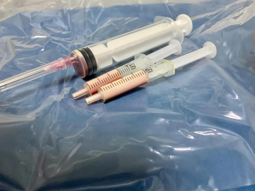 血脂高别硬扛！46岁大哥突发胰腺炎，医生抽血——管子里的血白得像牛奶！

46岁