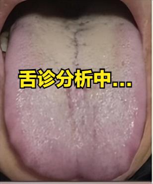 这种舌头，还在不停补肾，简直是拿生命开玩笑，我只用一招，一调一个准。
这会不忙，