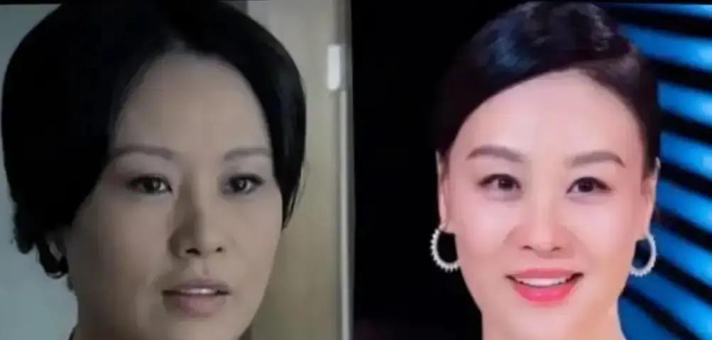 55岁张嘉译弯腰买菜，背影像70岁
 
他推着菜篮，脊背弯成一把弓。强直性脊柱炎