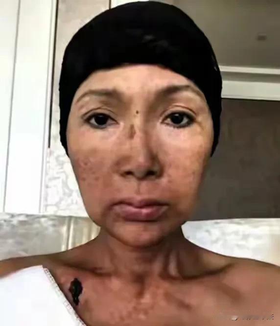 知名女歌手张咪先后患了3次癌，都在口腔位置，分别是扁桃体癌、口咽癌、舌癌，有网友