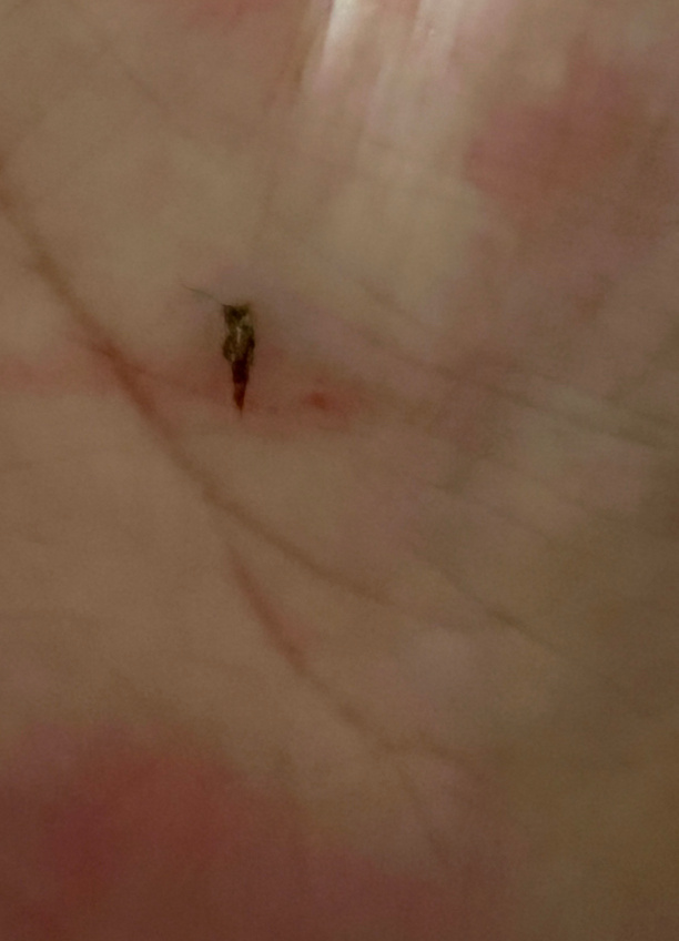 回家老二已经睡着了，老妈说让我好好看看蚊帐里有没有蚊子，好像给她咬了，我看了好久