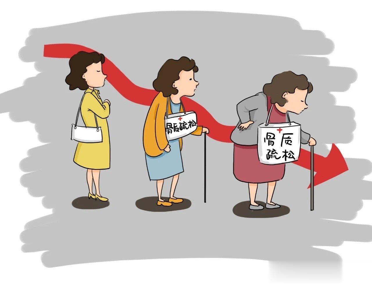 #DK强骨计划##健康食验计划# 40岁以上人群必做的骨骼检测应检测和了解自身骨
