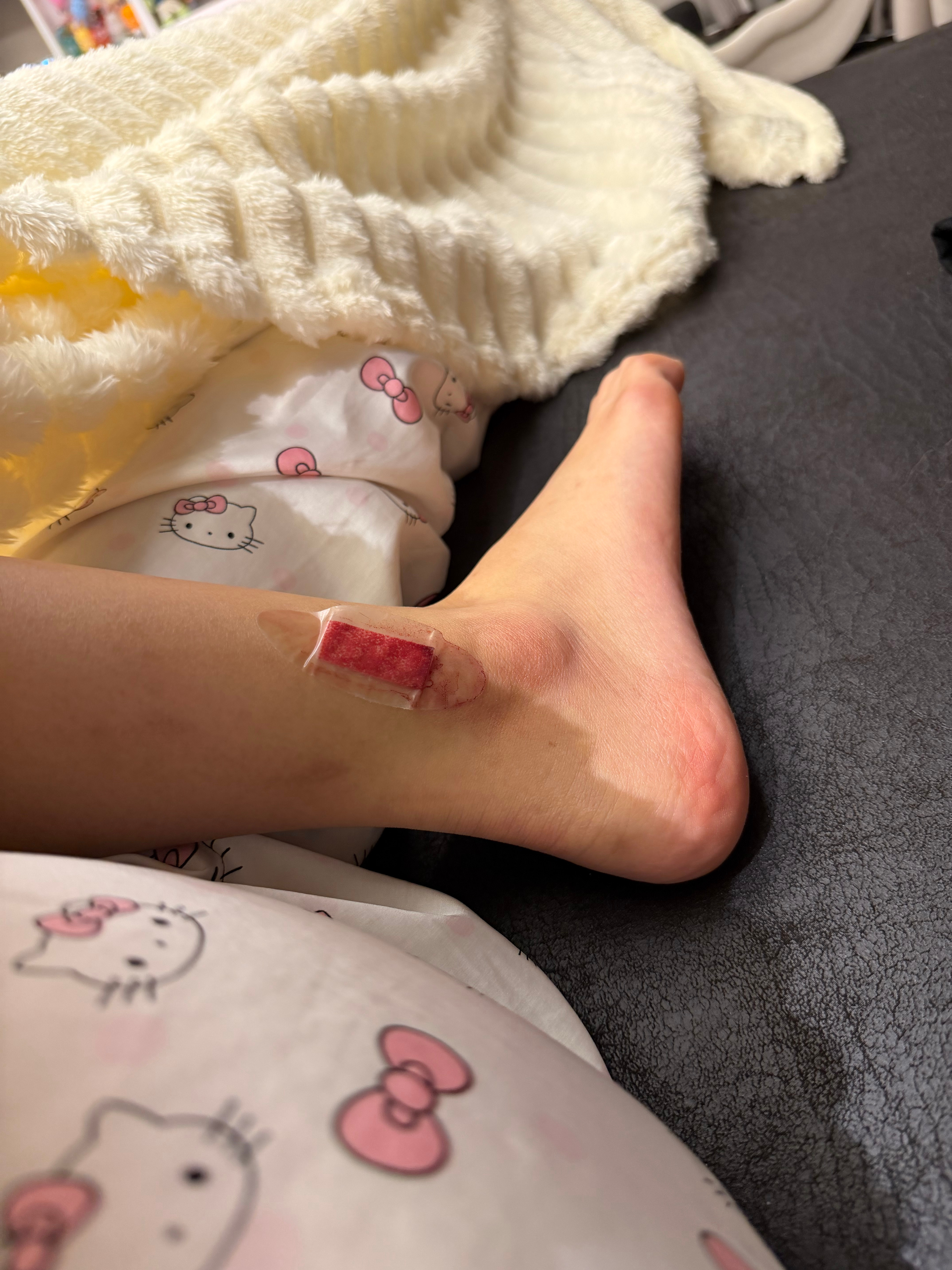 我发誓这是今年最后一次把自己弄伤了 ​​​