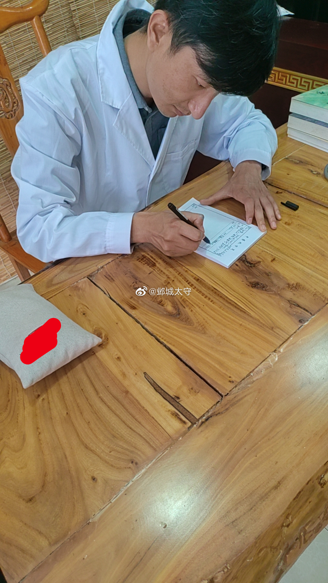 上上周一对父女来就诊：父亲双下肢水肿，按之凹陷，时有胸闷心慌，舌淡苔白腻，脉沉细