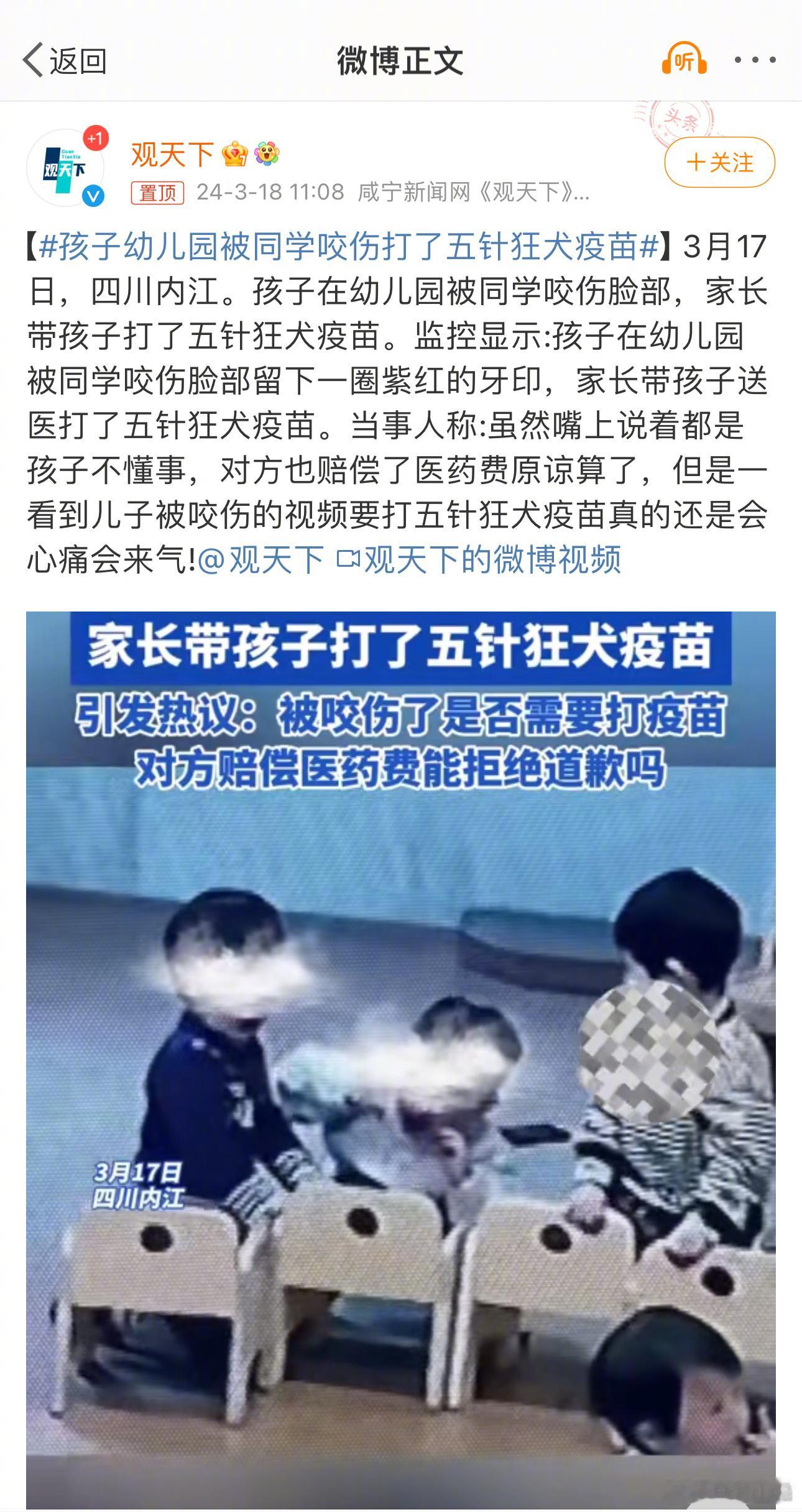 #孩子幼儿园被同学咬伤打了五针狂犬疫苗#这种现象的持续存在，是所有中国疾控医生的