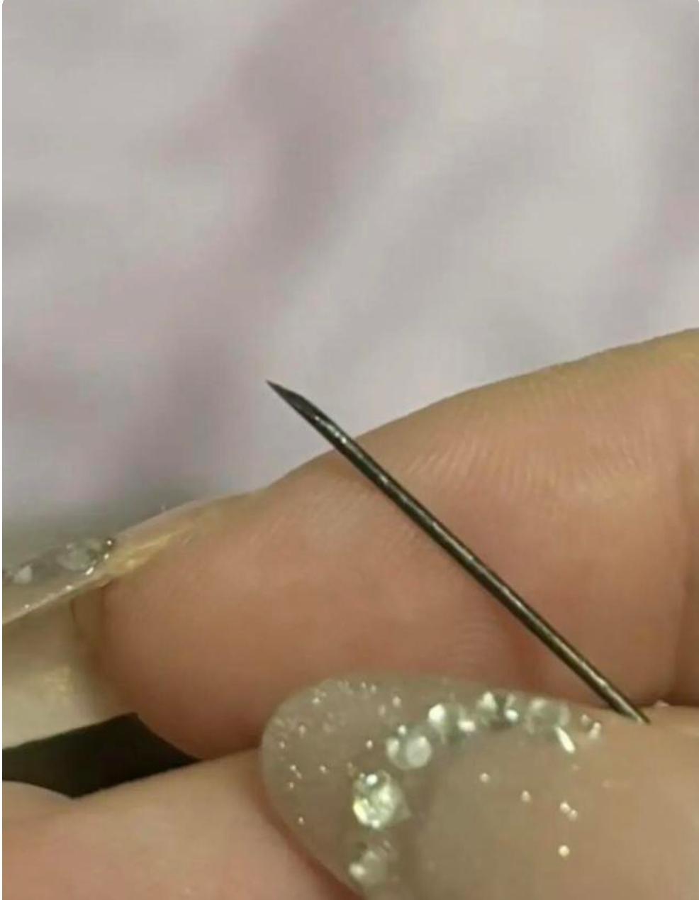 臀部疼了整整一个月，洗澡挤出发黑针头，来源至今成谜
 
浙江一名女子，左臀部持续