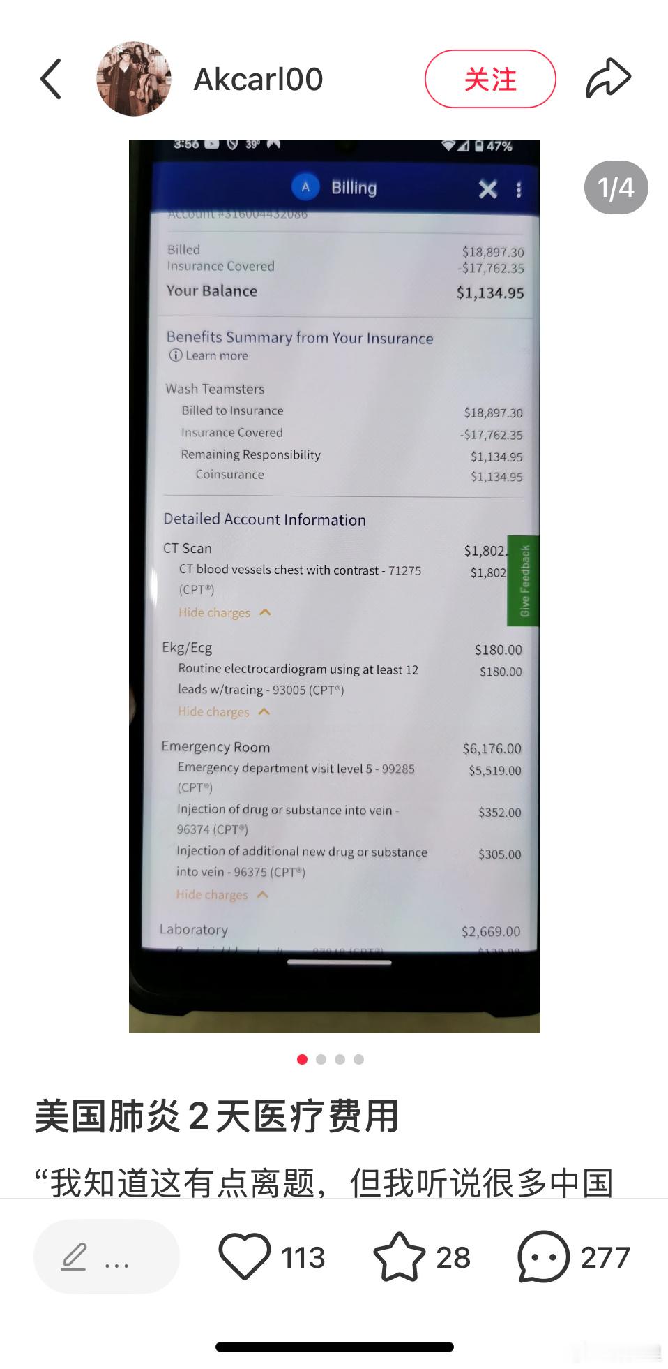 美国网友对账在美看肺炎，两天的医疗费用。两天总费用一万八刀，保险报了后，个人还需