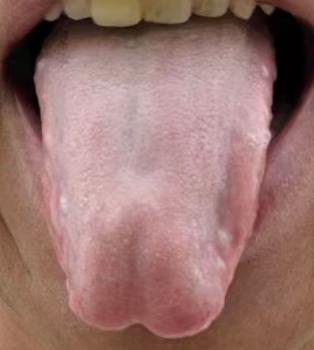 身体亏虚、精力不足？别盲目补肾，健脾才是核心






有不少伤精多年的朋友，