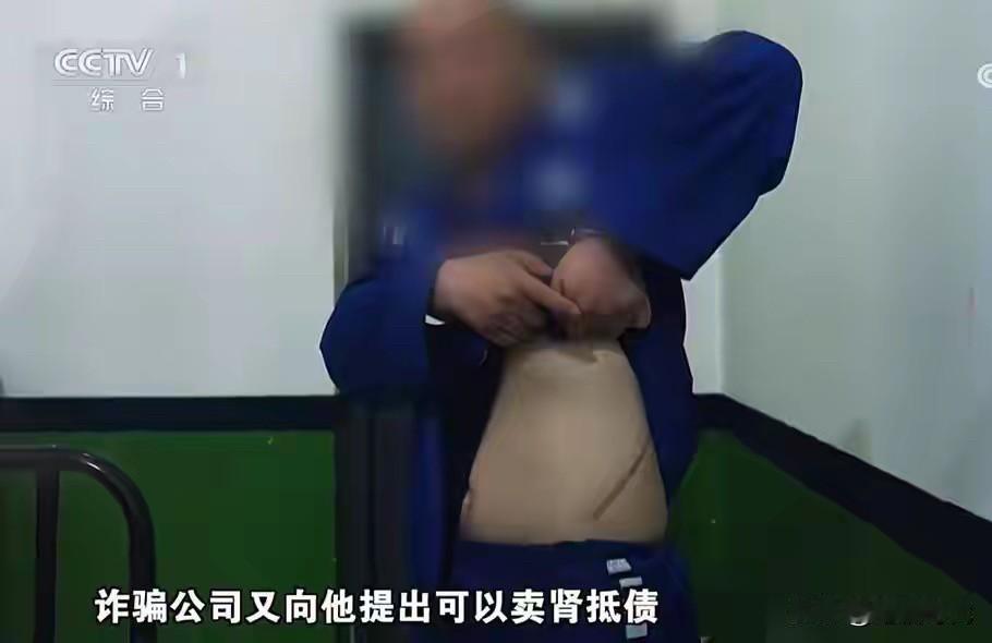 传了好几年的缅北“割肾传闻”，终于被血淋淋的真实经历证实！“不要说卖肾，为离开园