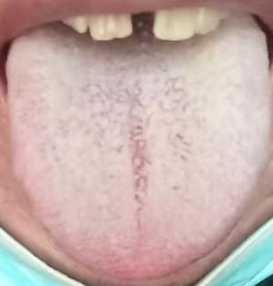 下焦痰湿气血不畅，传统方药疏通养护身体





很多人一旦出现功能问题就想着用