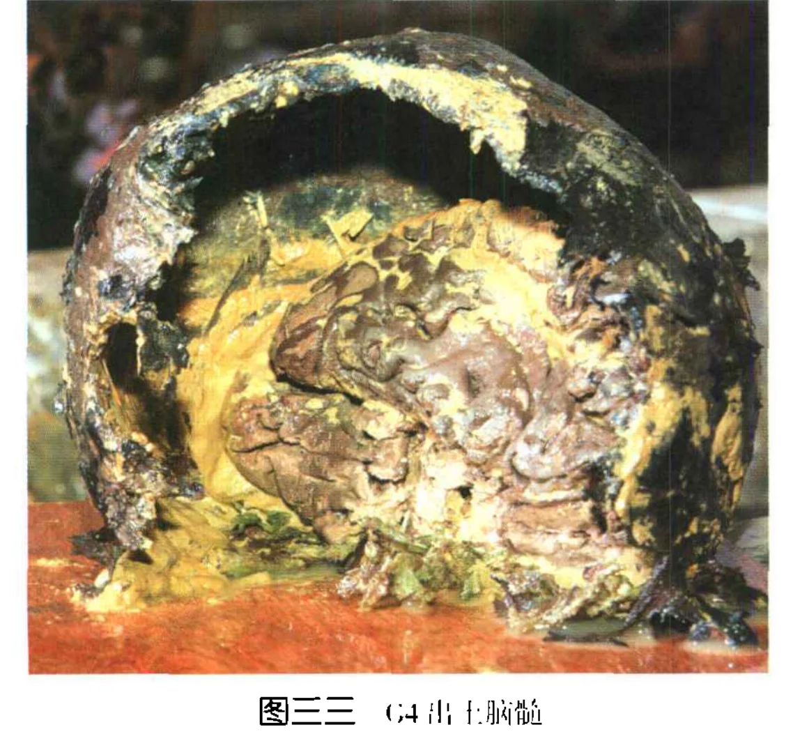 2500年前的人脑髓